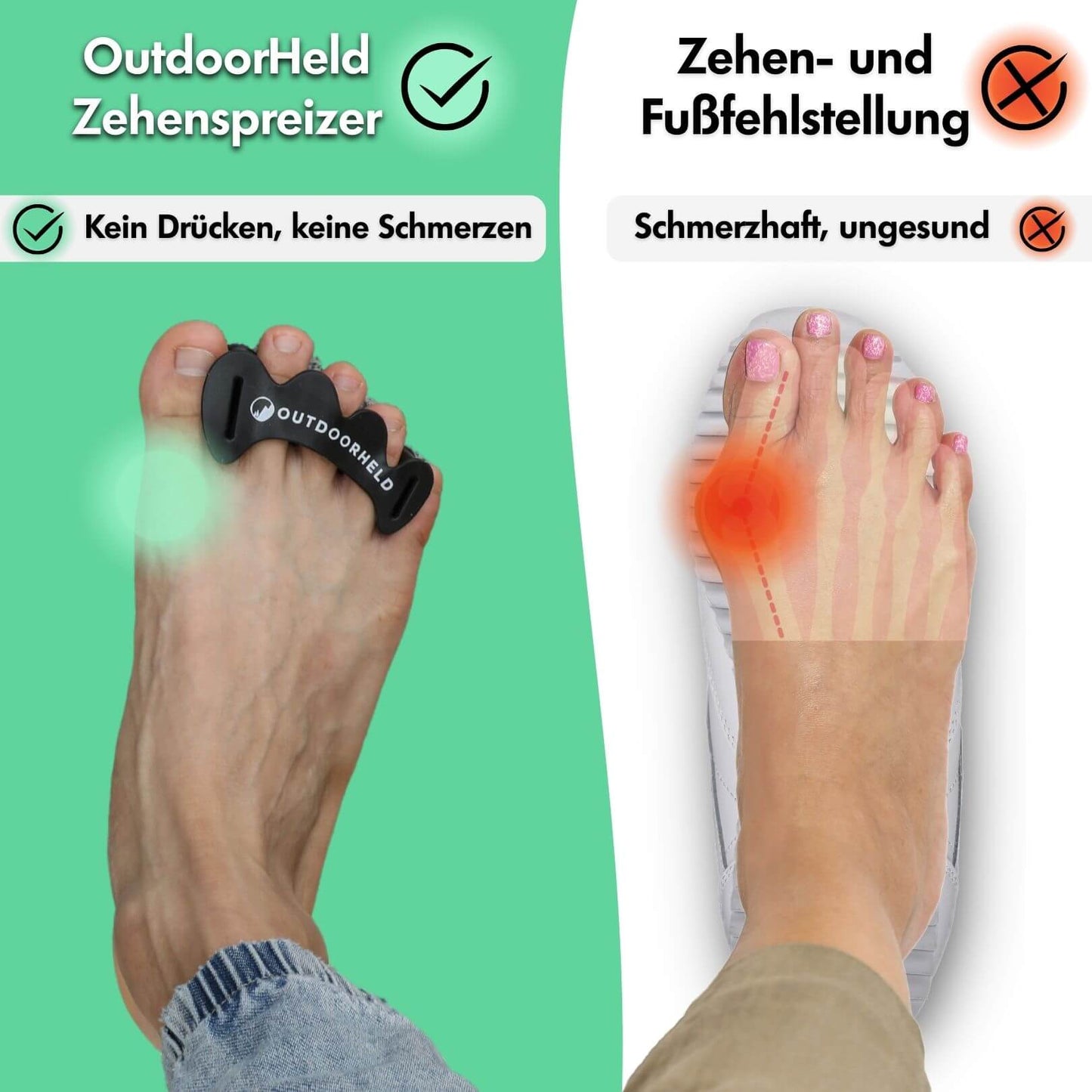 Zehenspreizer aus Silikon - für alle Zehenformen geeignet